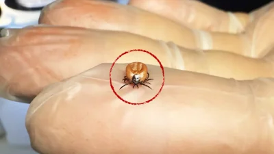 Kenelerden bulaşan Lyme hastalığı, MS ve romatoid artrit gibi ciddi