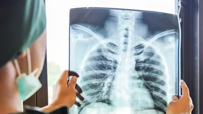 Göğüs Hastalıkları Anabilim Dalı Öğretim Üyesi Doç. Dr. Pınar Yıldız,