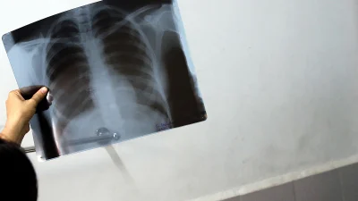 Bel ağrısı özellikle masa başı çalışanlar ve uzun süre ayakta