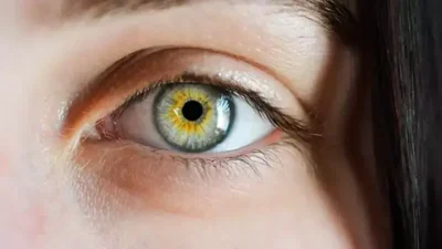 Göz Hastalıkları Uzmanı Op. Dr. Şeyda Atabay, göz altı morluklarının