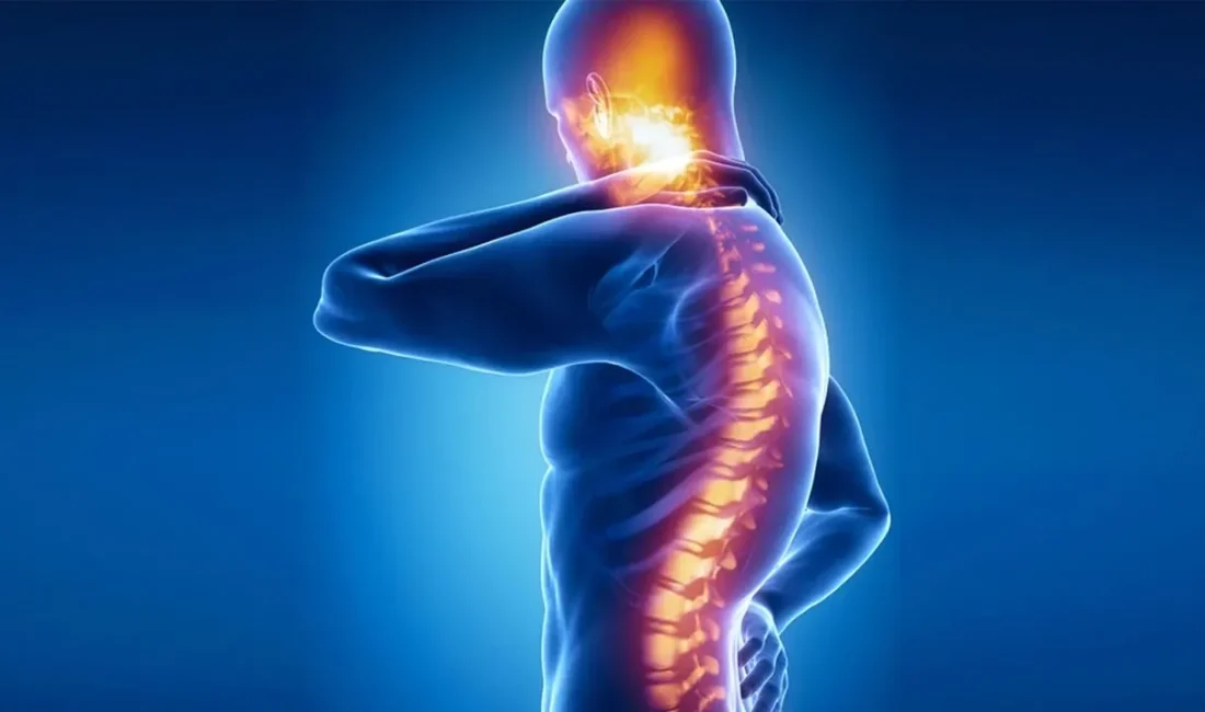 Spinal kord stimülasyon tedavisi, ağrı sinyallerinin beyne ulaşmasını engelleyerek kronik