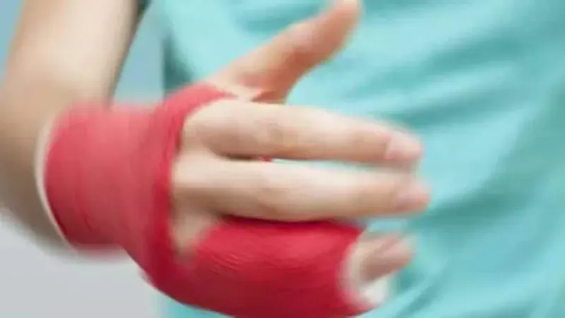 Rüyada elinin kırılması ne anlama gelir? Rüyada elinin kırılması nedir?