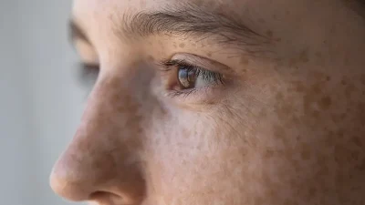 Biruni Üniversitesi Tıp Fakültesi Hastanesi Dermatoloji Uzmanı Dr. Öğr. Üyesi
