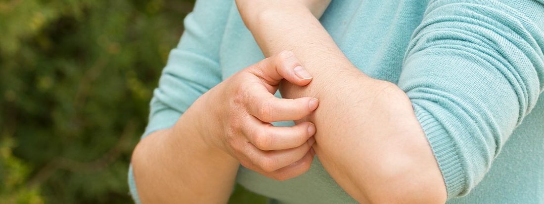 Yaz aylarında sık görülen sivrisinek ısırıklarının neden olduğu kaşıntıyı hafifletmek
