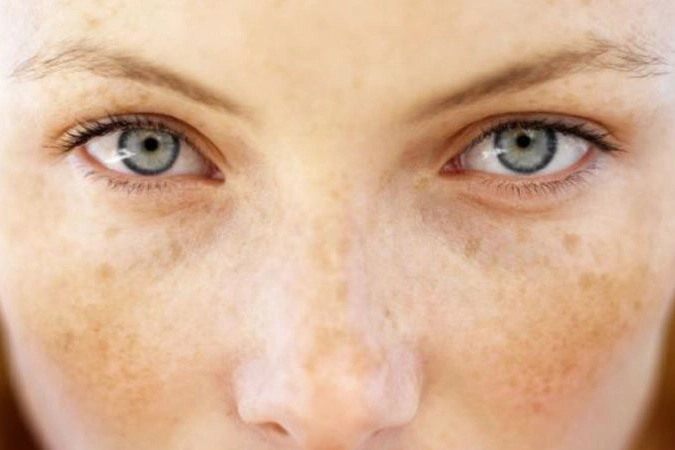 Dermatoloji Uzmanı Dr. Gülbiye Güler, yaz aylarında yoğun güneş maruziyetinin